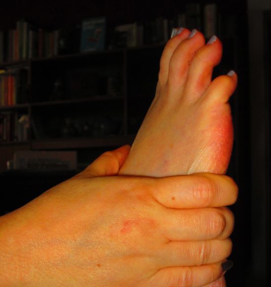 At eight weeks post-surgery, one is allowed to cross ankles, pivot awkwardly and bend at the hip more than ninety degrees. My foot met me half-way, which was right friendly.